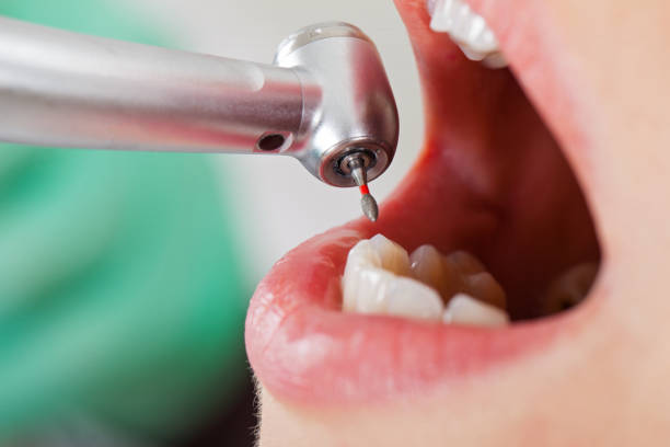Best Weekend Emergency Dentist in Empire, CA